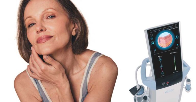 Radiofréquence Fractionnée EXION™️